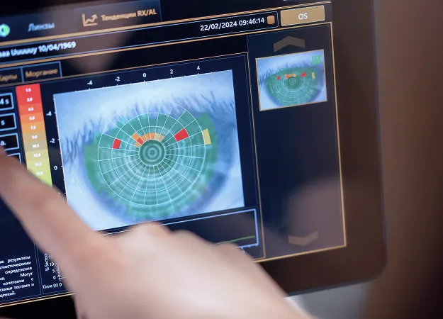 Laser Vision Correction