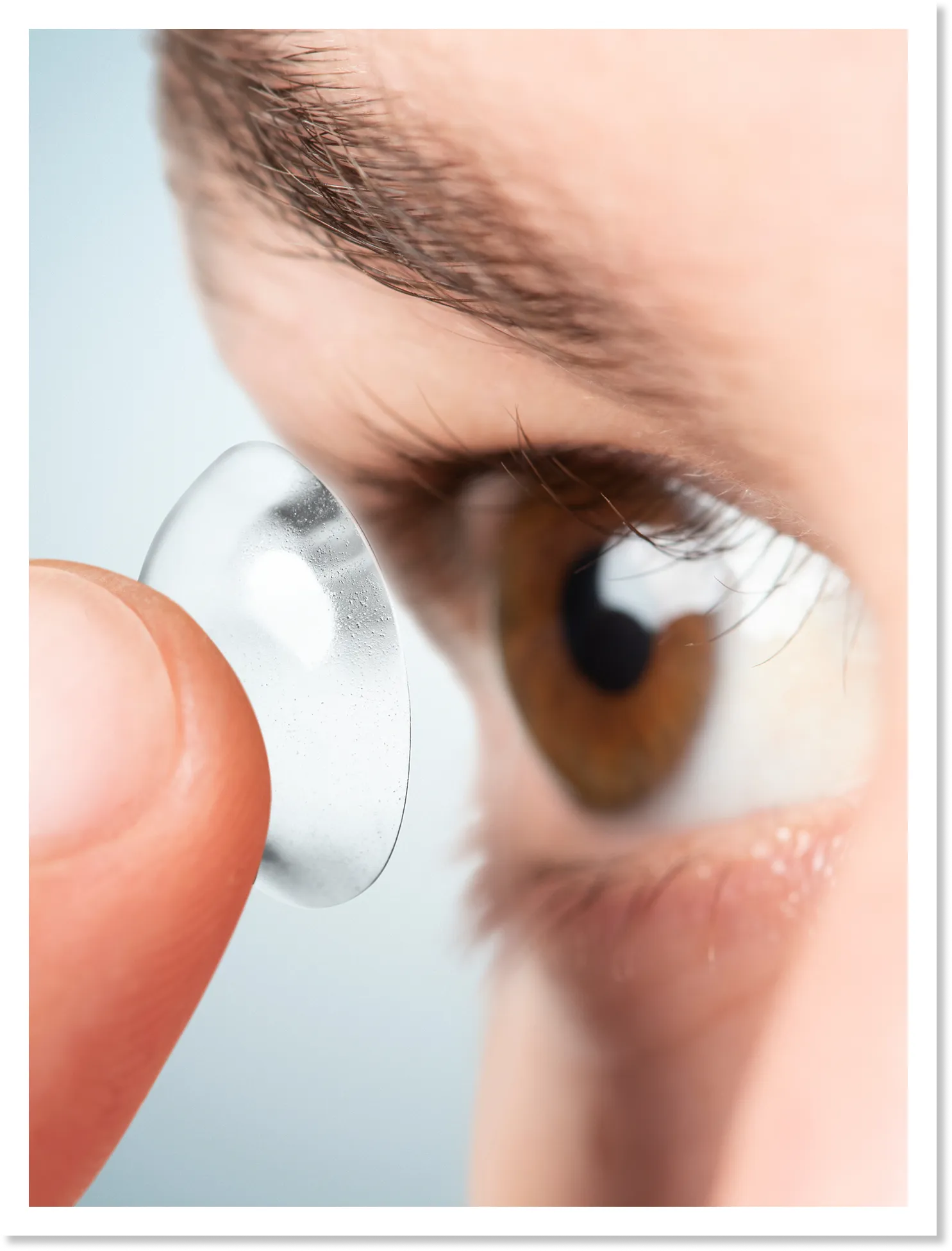 Contact Lens